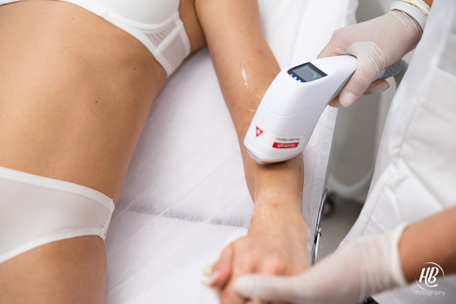 Epilare definitiva laser